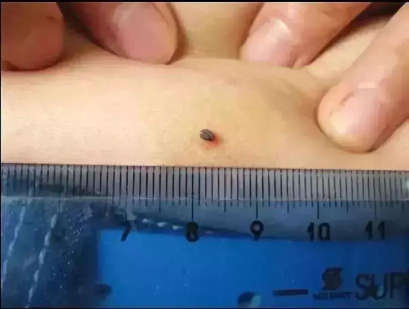 小明快樂疫情日志，最新疫情發(fā)布與日常觀察